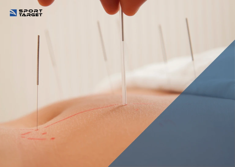 Dolori mestruali intensi, cicli irregolari e sindrome premestruale e agopuntura